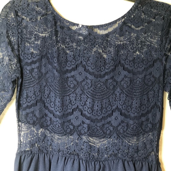 H&M SHORT DRESS - Picture 5 of 6